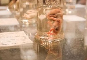 试管移植后腹胀想放屁原因总结，主要受服用黄体酮影响