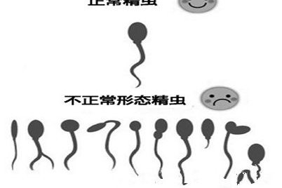 浙江杭州三代试管费用高吗？详细解析！